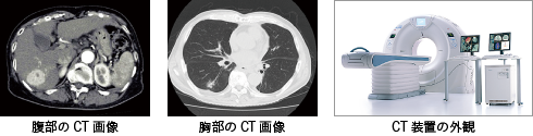 CT検査画像