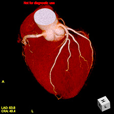 心臓CT画像
