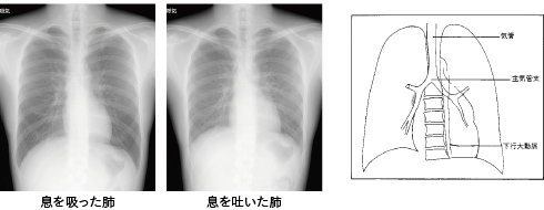 胸部エックス線写真
