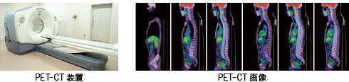 PET（PET-CT）検査