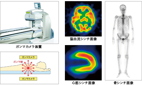 核医学（アイソトープ）検査